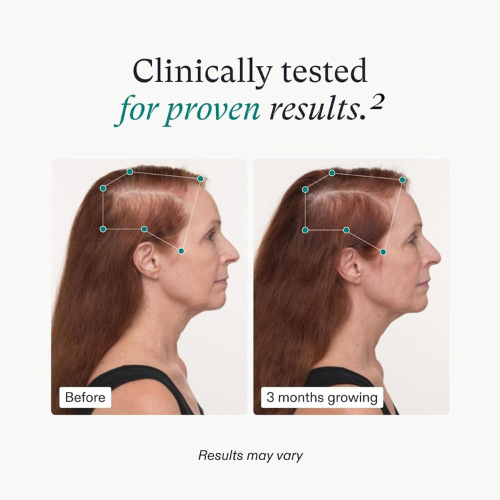 Nutrafol Women's Balance – Hair Growth Supplement for Ages 45+, 1-Month Refill Pouch