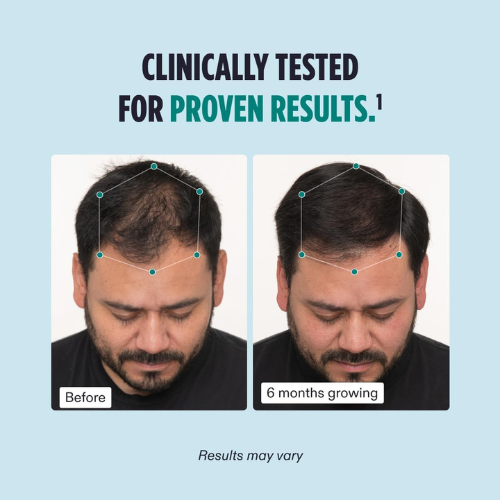 Nutrafol Men's – Hair Growth Supplement, Clinically Tested, 1-Month Supply