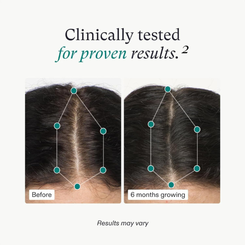 Nutrafol Women's – Hair Growth Supplement for Ages 18-44, 1-Month Supply