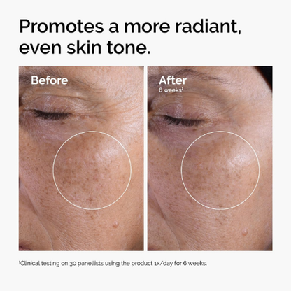 The Ordinary Glycolic Acid 7% Exfoliating Toner – Brightening & Smoothing | 240ml